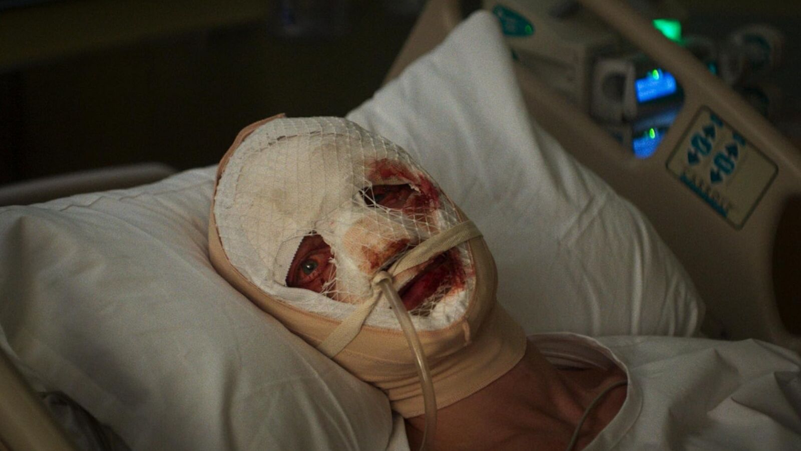CLayface in het ziekenhuis