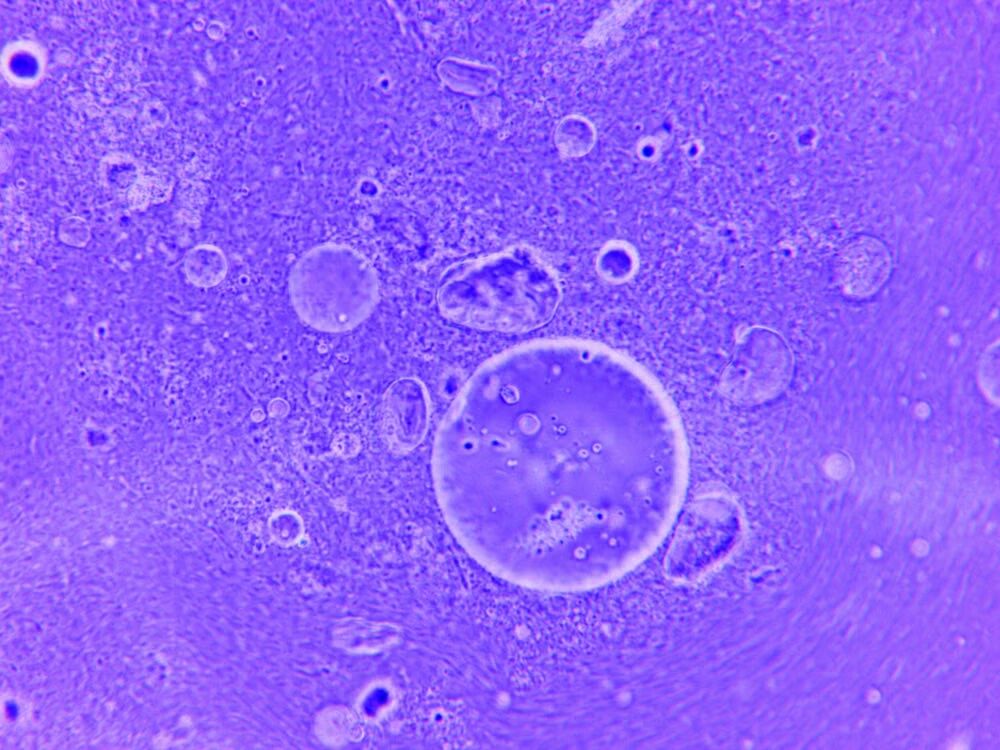 Een cel onder een microscoop