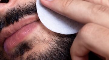 jeukende baard