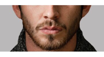kale plekken baard